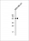 DMP1 Antibody (N-term)